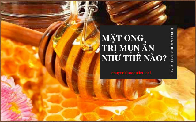 mật ong trị mụn ẩn1