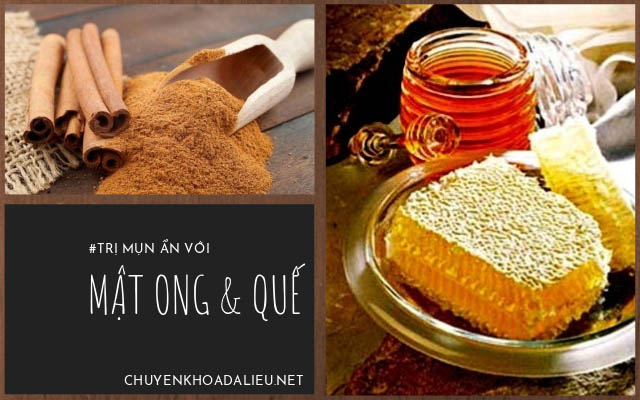 mật ong trị mụn ẩn2