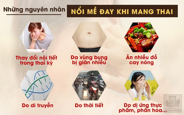 Nguyên nhân nổi mề đay khi mang thai