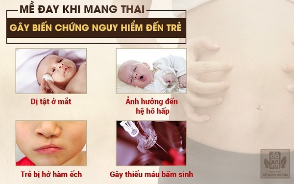 Nổi mề đay khi mang thai có thế gây biến chứng nguy hiểm đến mẹ bầu và thai nhi