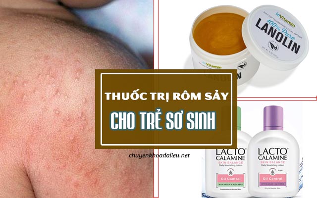 thuốc chữa rôm sảy ở trẻ sơ sinh