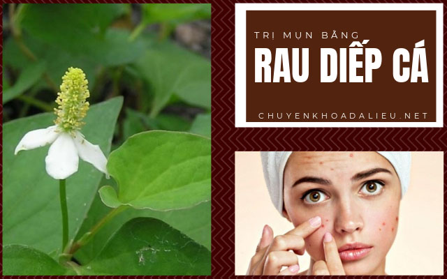 rau diếp cá trị mụn