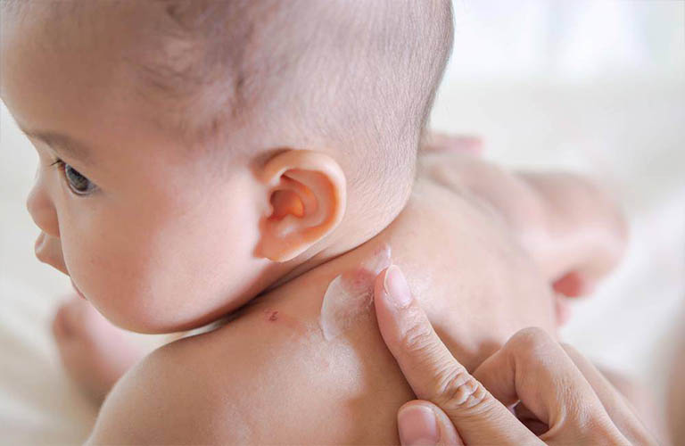 áp dụng các biện pháp dưỡng ẩm cho bé