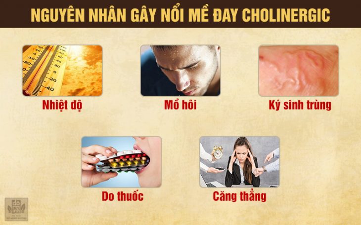 5 nguyên nhân gây ngứa nổi mề đay cholinergic