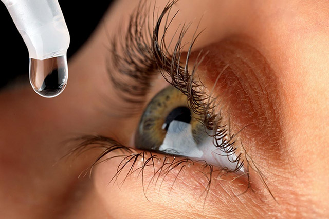 Các loại thuốc nhỏ mắt có thể làm giảm triệu chứng dị ứng ở mắt