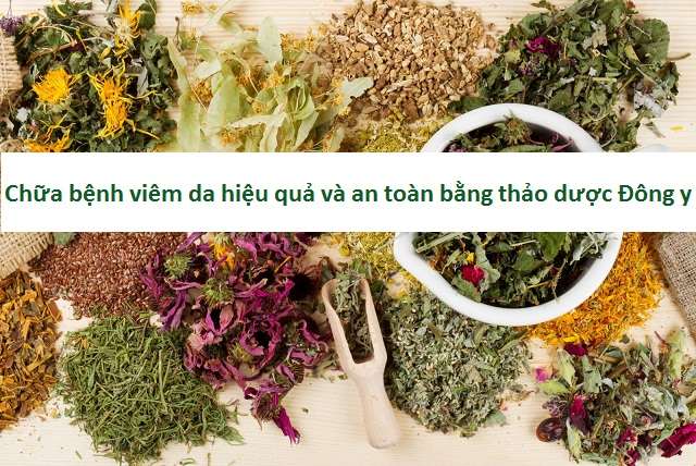 Thảo dược Đông y chữa bệnh viêm da