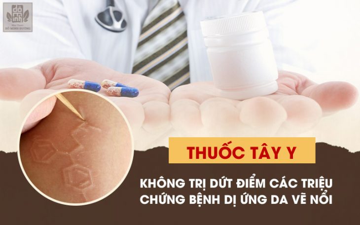 Nổi mề đay Nguyên nhân do đâu và cách điều trị #42 Nổi mề đay Nguyên nhân do đâu và cách điều trị