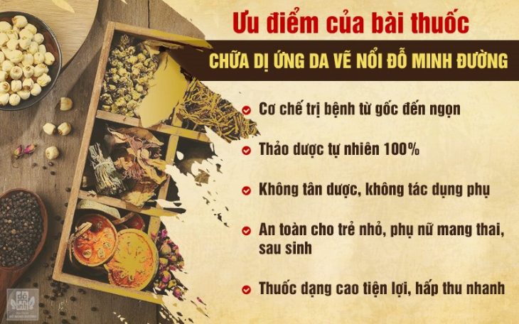 Tại sao nên chữa dị ứng da vẽ nổi tại Đỗ Minh Đường