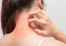 Dị ứng có nguy hiểm không?