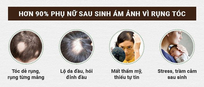 Hơn 90% phụ nữ bị rụng tóc sau sinh