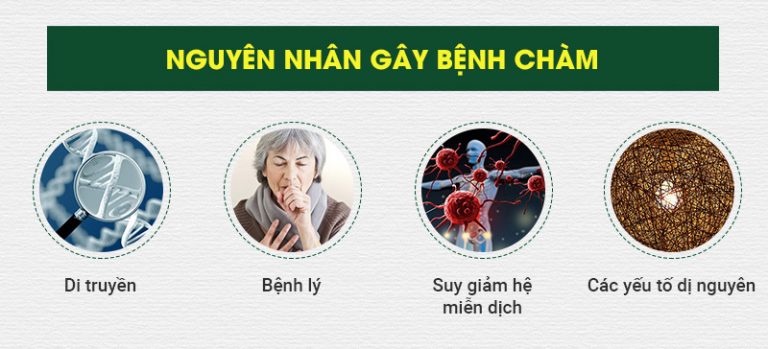 Nguyên nhân gây bệnh chàm