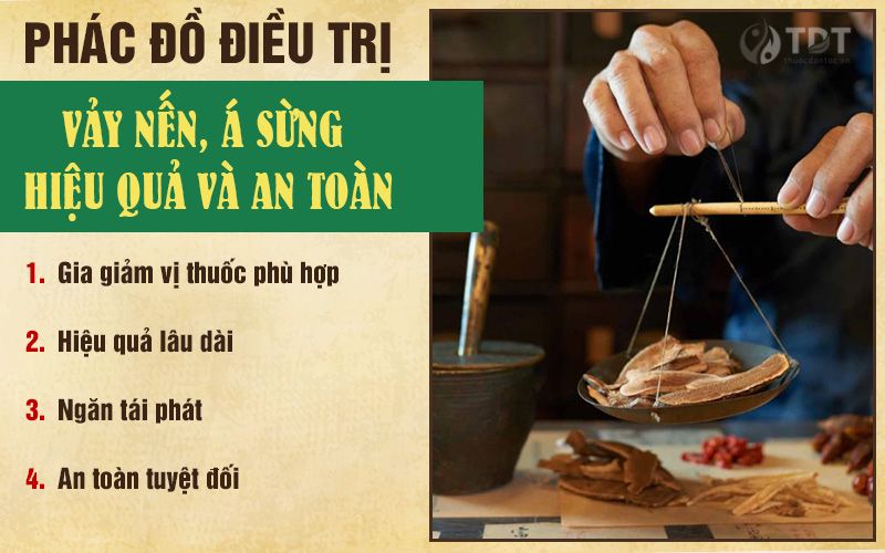 Phác đồ điều trị vảy nến và những ưu điểm vượt trội