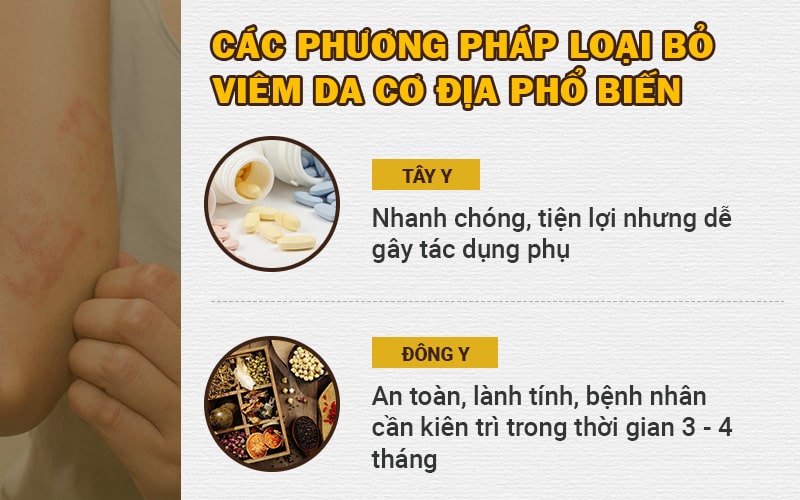 Bệnh viêm da cơ địa