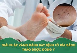 Bệnh tổ đỉa và cách chữa