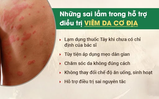 Sai lầm khi xử lý viêm da cơ địa