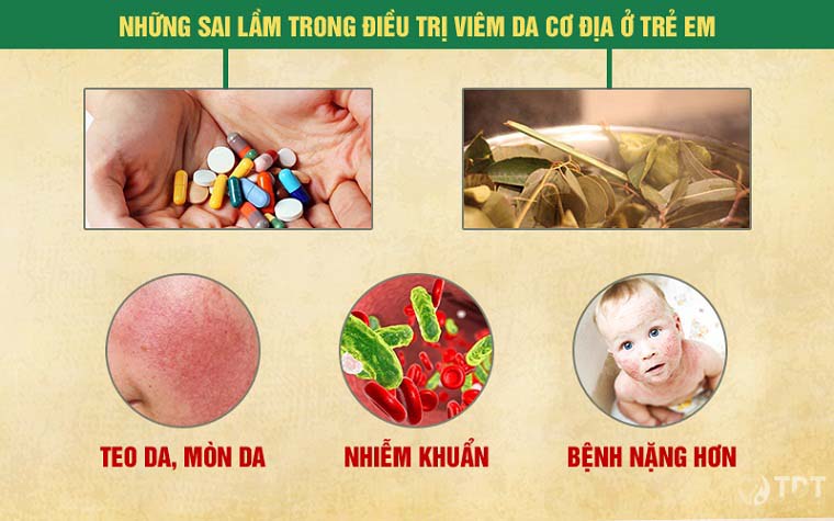 Điều trị viêm da cơ địa ở trẻ em