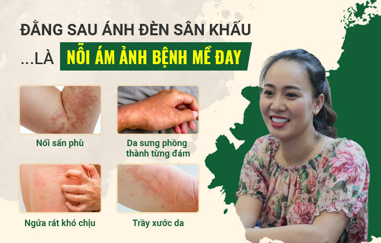 Đã có khoảng thời gian diễn viên Khánh Linh về nhà đi con bị mề đay mẩn ngứa hành hạ