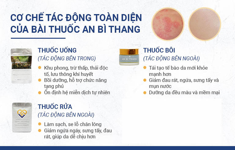 3 chế phẩm chính trong điều trị viêm da tiếp xúc của bài thuốc An Bì Thang