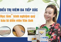 Kinh nghiệm điều trị viêm da tiếp xúc của diễn viên Vân Anh