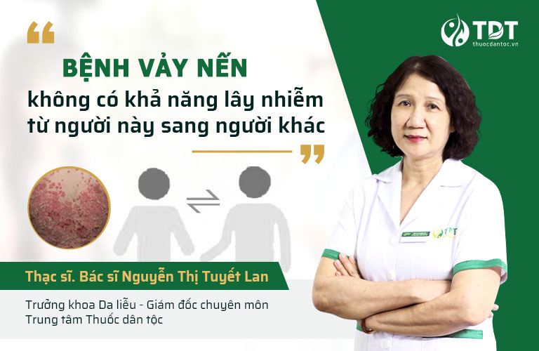 Bệnh không lây nhiễm như nhiều người lầm tưởng