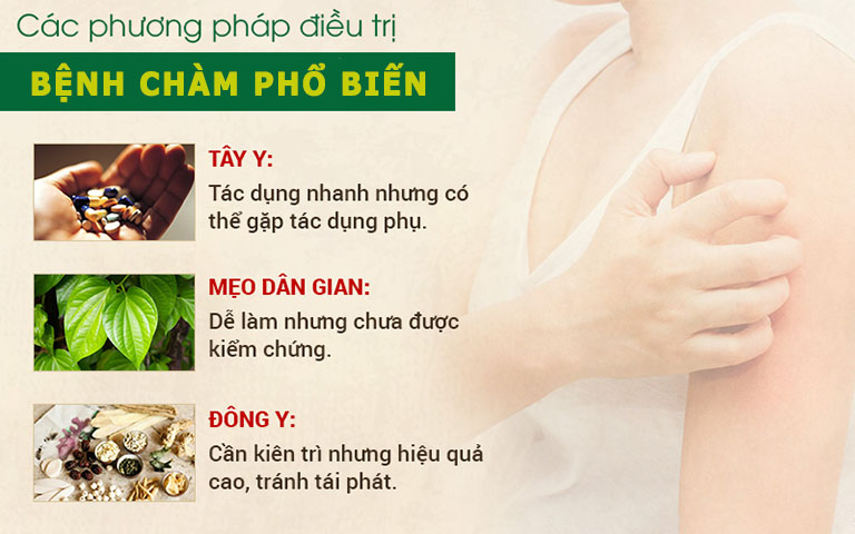 Điều trị bệnh chàm bằng Tây y và dân gian còn tồn tại nhiều hạn chế