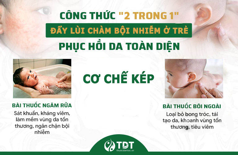 Công thức "2 trong 1" xử lý chuyên sâu chàm bội nhiễm ở trẻ