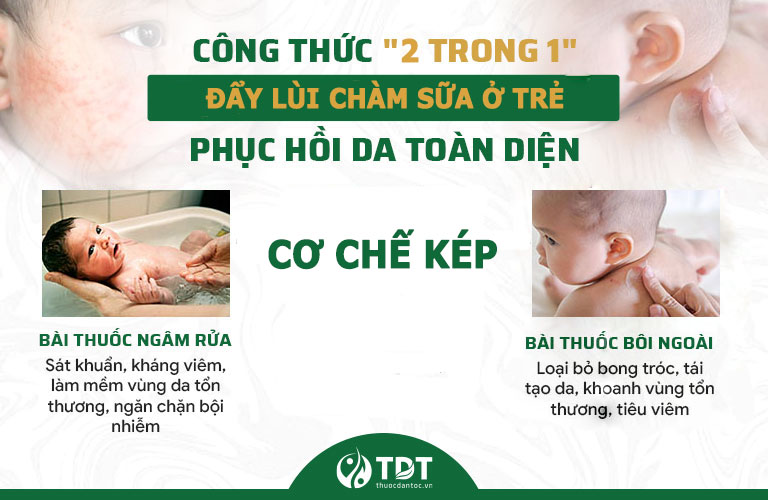 Công thức "2 trong 1" xử lý chuyên sâu chàm sữa ở trẻ