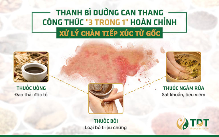 3 nhóm thuốc kết hợp xử lý chàm tiếp xúc từ gốc