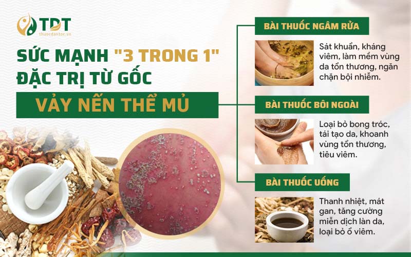 Từng nhóm thuốc tác động chuyên sâu vào căn nguyên bệnh