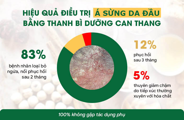 Hiệu quả điều trị á sừng da đầu với bài thuốc Thanh bì Dưỡng can thang