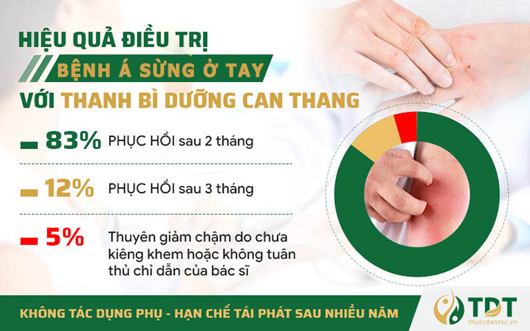 Tỷ lệ bệnh nhân khỏi dứt á sừng ở tay lên đến 95% sau 1 liệu trình