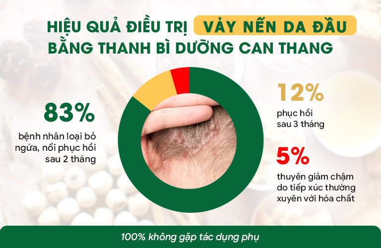 Hiệu quả điều trị thành công vảy nến da đầu với bài thuốc