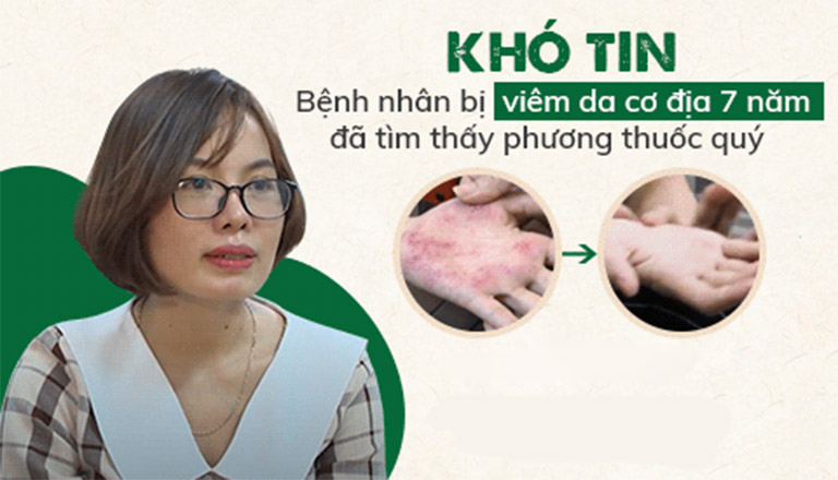 Chị Thoả đã lành bệnh, khôi phục vân tay và trở lại cuộc sống bình thường