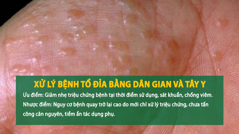 Mẹo dân gian vẫn tồn tại nhiều hạn chế