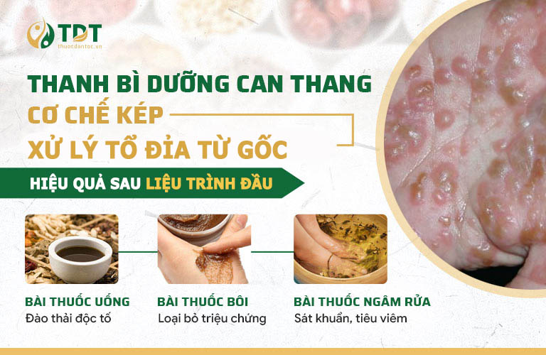 Công thức thuốc xử lý chuyên sâu bệnh tổ đỉa