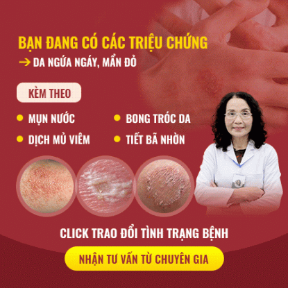 Banner triệu chứng